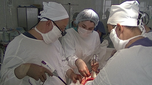 В клинике БГМУ выполнена гибридная операция пациенту с раком почки с опухолевым тромбозом нижней полой вены и правого предсердия